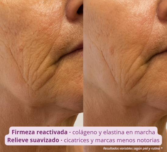 DermaRoller 540™ — Despierta la regeneración natural de tu piel.