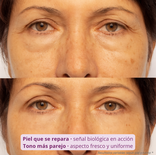 DermaRoller 540™ — Despierta la regeneración natural de tu piel.