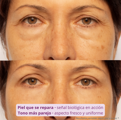 DermaRoller 540™ — Despierta la regeneración natural de tu piel.